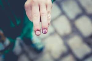  Personal Injury Compensation