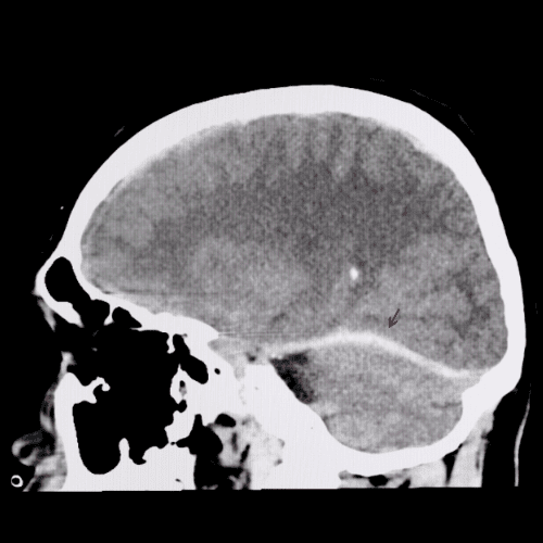 Catastrophic Injury Lawyer in Tulsa